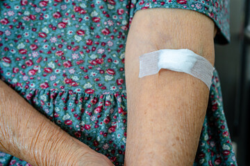 Asian senior or elderly old lady woman patient show cotton wool stop bleeding, after blood drawing...