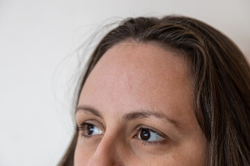 Close-up of a scar on a woman's forehead