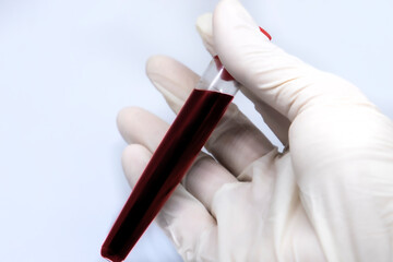 Scientist in protective white gloves holding test tube with blood sample in it, isolated white background 