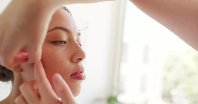 Closeup of hands putting acupuncture needles on a female patients face. An acupuncturist is treating a young woman in her clinic. Therapist releasing facial muscle tension with a holistic treatment