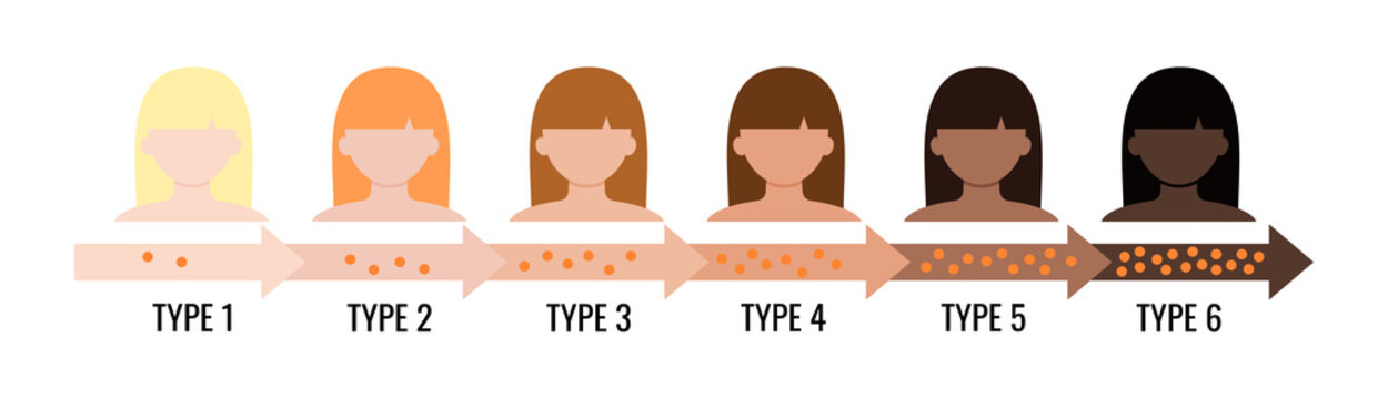 Fitzpatrick skin tone phototype  melanin index chart with female avatar. Graphic design element with type I II III IV V IV human skin hair color melanin content in the cell flat vector illustration