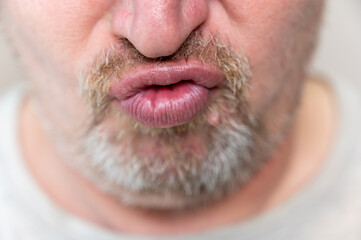 Obraz premium A mature man is crooked. The lower part of the male face. The man has his mouth gathered into a tube, grimacing. Male with stubble. Gray hair on his beard and mustache. Close-up. Selective focus.