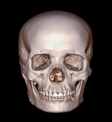 Skull 3D from CT Scan of facial bone 3D rendering showng human skull © samunella