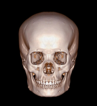 Skull 3D from CT Scan of facial bone 3D rendering showng human skull