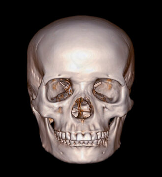 Skull 3D from CT Scan of facial bone 3D rendering showng human skull