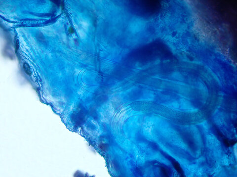 カゲロウの幼虫の寄生虫（100倍）の顕微鏡写真