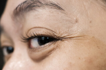 Close-up Face of a Woman with Wrinkled Eyelines and Eyebags due to Aging and Lack of Rest