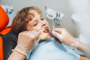 Portrait of a child patient and the hands of a pediatric dentist with dental forceps, close-up. painless extraction of teeth. pediatric dentistry.
