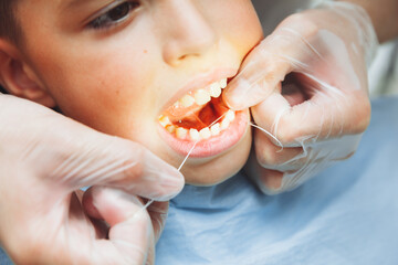 the dentist brushes the boy's teeth with dental floss. oral hygiene in children. pediatric...