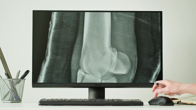 Doctor veterinarian examining horse leg skeleton roentgen on computer monitor. Woman vet analyzing animal bones x-ray, joint close-up. Healthcare and medicine concept.
