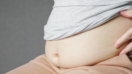 Woman rolls out corrective pants and releases fat belly. Flabby female belly after pregnancy. Woman measures fat on stomach touching sagging skin closeup - obrazy, fototapety, plakaty