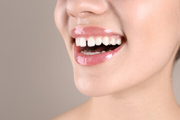 Woman with diastema between upper front teeth on light grey background, closeup