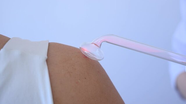The doctor uses the darsonval apparatus against acne on the shoulder of a female patient.