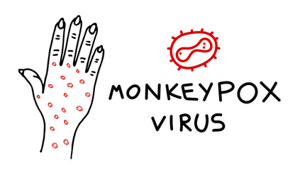 Monkeypox virus infection on hand drawing banner concept. Monkey pox disease outbreak blisters and rash on hand skin. MPV MPVX danger and public health epidemic risk. Vector eps linear illustration