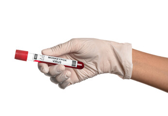 Female doctor with blood sample on white background. Monkeypox virus