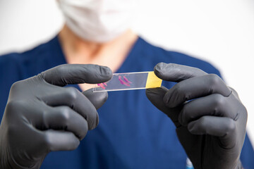 doctor in black gloves holds stained histology slide which is ready for microscopic examination....