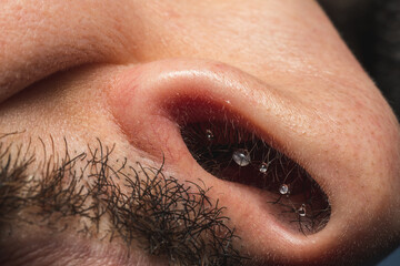 A detail shot of frozen water droplets in a nose at winter.