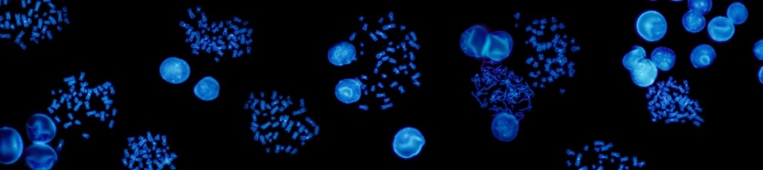 Chromosomes under fluorescence microscope, fluorescence in situ hybridization technique, Human chromosomes from blood