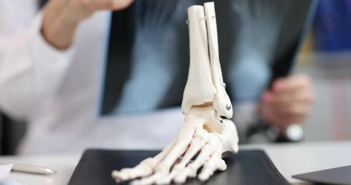 Trauma surgeon evaluates x-rays of legs