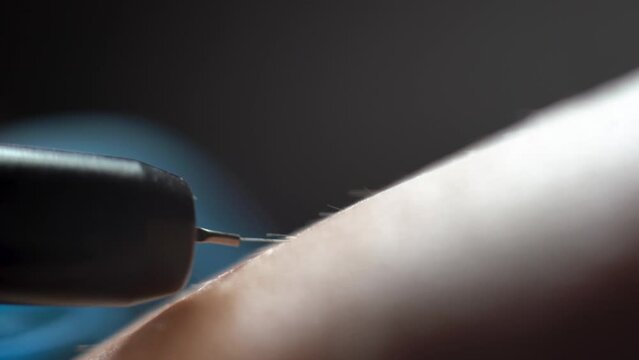 close-up of female legs during epilation by a professional beautician in gloves. Spa, beauty industry, clinic treatment, electrolysis. hair removal, macro