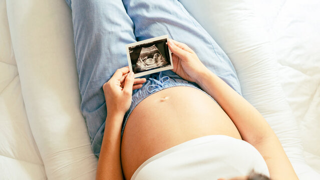 Ultrasound photo pregnancy baby. Woman holding ultrasound pregnant picture. Concept maternity, pregnancy, childbirth.