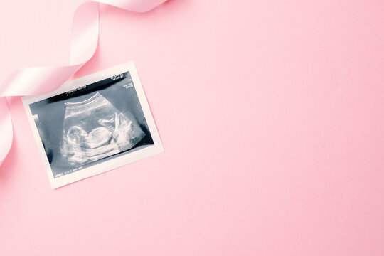 Ultrasound photo pregnancy baby. Fashion cute baby cloth with ultrasound pregnancy picture on pink background. Concept of pregnancy, maternity, expectation for baby birth.