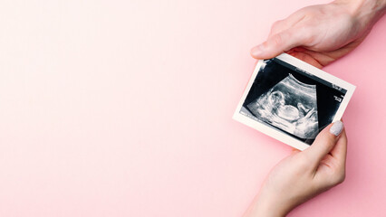 Ultrasound image pregnant baby photo. Woman hands holding ultrasound pregnancy picture on pink background. Pregnancy, medicine, pharmaceutics, health care and people concept.
