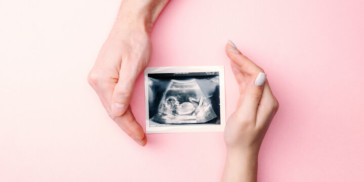 Ultrasound photo pregnancy baby. Woman hands holding ultrasound pregnant picture on pink background. Concept maternity, pregnancy, childbirth.
