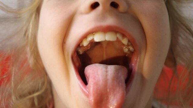Close-up of a child's mouth wide open. The girl opens her mouth wide and sticks out her long tongue. The kid shows her teeth and soft palate