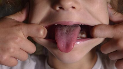 A close-up of a girl's funny face. Baby making faces. The girl puts her fingers in her mouth and stretches her cheeks. Teeth can be seen. Moves and pulls out his tongue