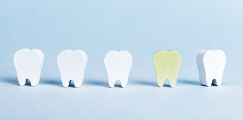 White teeth row and yellow one with plaque, cavity. Poor oral hygiene, dental problems, gum...