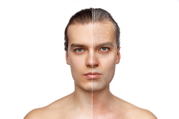 Man's portrait in comparison youth and maturity, old age. Skin aging process, wrinkles. Plastic...