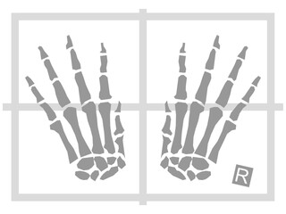 hands xray illustration