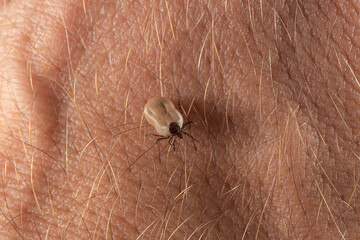 Macro top view of a tick isolated on skin with hair