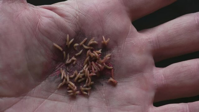 Worms in a Human Palm. Close-up of a large ball of worms teeming in the injured palm