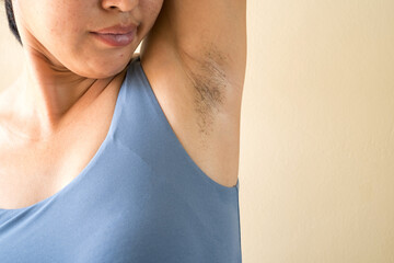 Woman showing her arms up and showing armpit hair.Unshaven armpit hair. Problem skin under the armpit. Healthcare and skincare concept.
 - obrazy, fototapety, plakaty