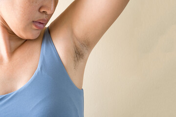 Woman showing her arms up and showing armpit hair.Unshaven armpit hair. Problem skin under the armpit. Healthcare and skincare concept.

