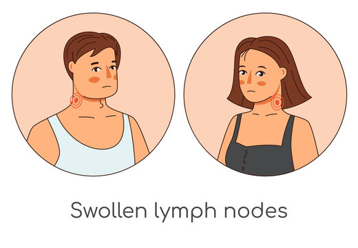 Swollen lymph nodes man and woman icons