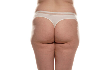 Overweight woman with fat cellulite legs and buttocks, obesity female body, white background