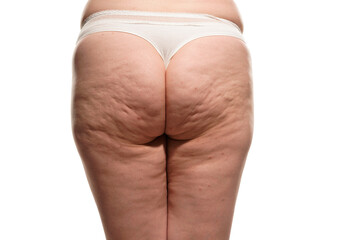 Overweight woman with fat cellulite legs and buttocks, obesity female body, white background - obrazy, fototapety, plakaty