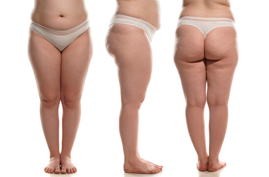 Front side and back view of overweight woman with fat cellulite legs, buttocks and belly, obesity female body, white background