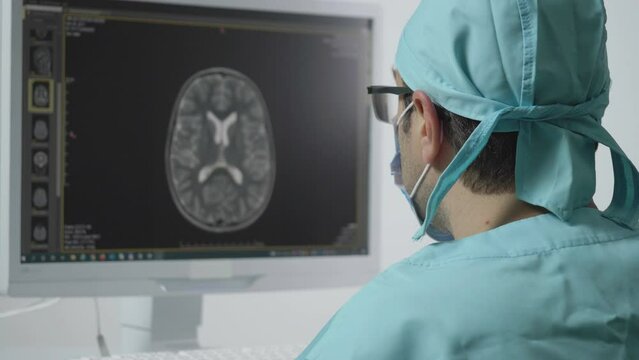 Medic doctor looking at patient brain magnetic resonance image before surgery