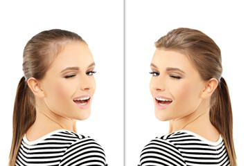 Thinning hair and hair loss,female pattern baldness,Hair transplant