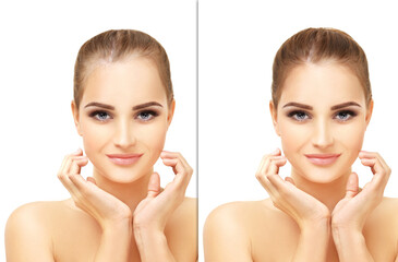 Thinning hair and hair loss,female pattern baldness,Hair transplant