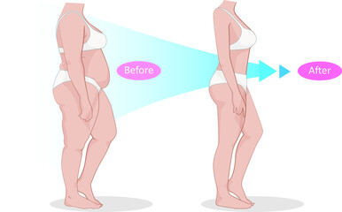 Shape before and after From fat woman to thin.