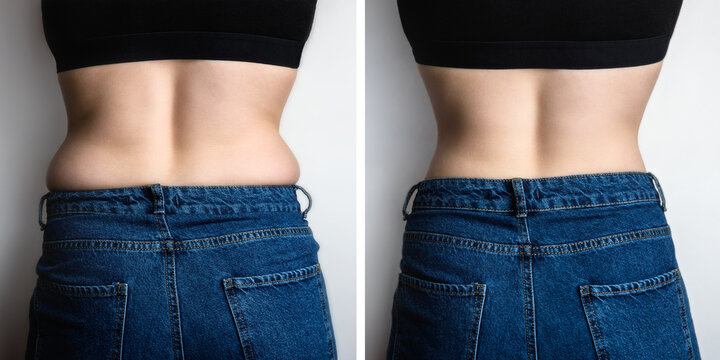 Slim and fat female sides on back comparison. Before and after weight loss.