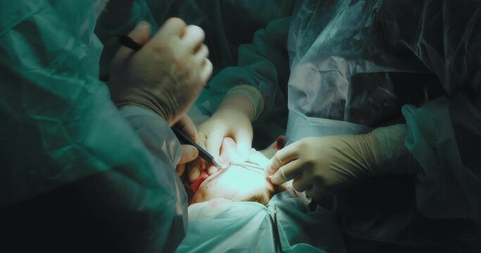 Team of surgeons in sterile suits perform blepharoplasty surgery. The surgeon makes an incision in the crease of the eyelid with a surgical instrument