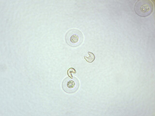 杉の花粉1（400倍）の顕微鏡写真