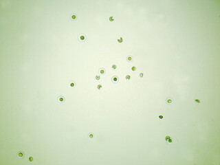 杉の花粉2（100倍）の顕微鏡写真