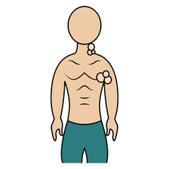 Fototapeta premium Enlarged lymph nodes. Color vector illustration. The patient has inflamed lymph nodes in the neck and armpits. A symptom of a disorder in the body. Isolated background. Cartoon style. Medical theme. 